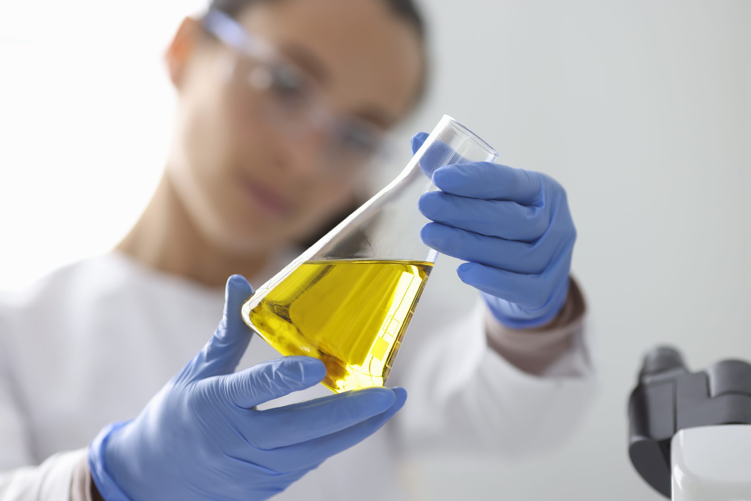 Female hands in rubber gloves holding flask with urine analysis in clinical laboratory closeup